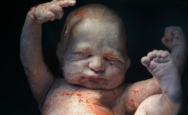 תמונות לידה מדהימות (צילום: קרטרס ניוז אג'נסי לדיילי מייל)