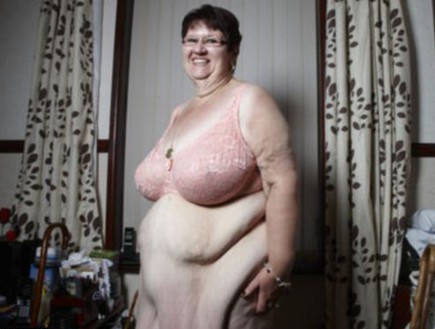 אישה שמנה מאוד (צילום: channel 4)