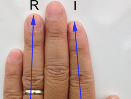 יחס בין האצבעות (צילום: צילום מסך)