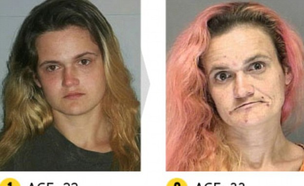 מסוממים לפני ואחרי (צילום: Rehabs.com)