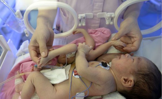 תינוק עם 8 ידיים ורגליים (צילום: Ynagcheng Evening News)