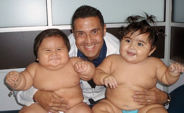 תינוקות ששוקלים 41 קילו (צילום: גורדיטוס דה קורזון)
