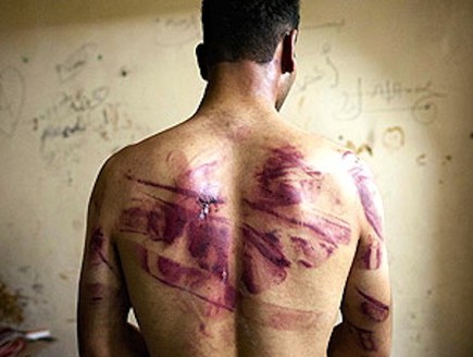 התעללות בסוריה (צילום: AFP, GettyImages IL)