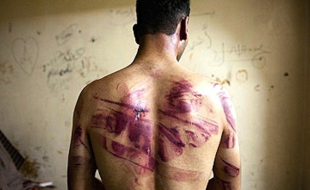 התעללות בסוריה (צילום: AFP, GettyImages IL)