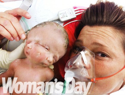 תינוק פנים כפולות (צילום: Woman's Day)
