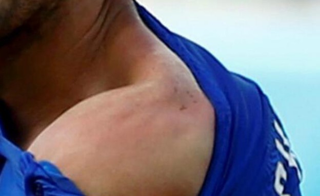 הכתובת היתה על הכתף