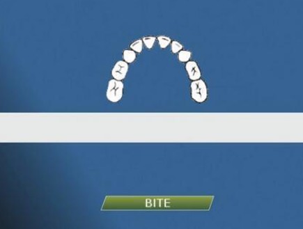 טכנולוגיית קו השיניים (צילום: twitter)