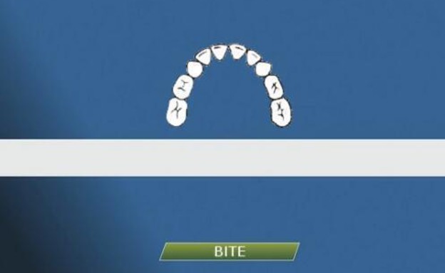 טכנולוגיית קו השיניים