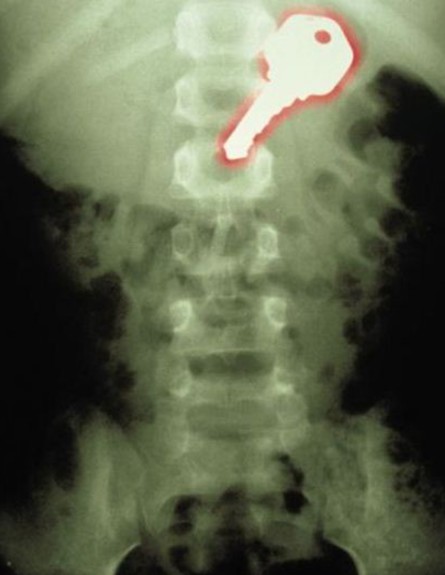 רנטגן הזוי (צילום: viralnova.com​)