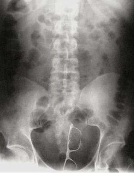 רנטגן הזוי (צילום: viralnova.com​)