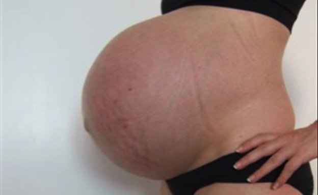 השלישייה האוסטרלית (צילום: http://sharpen-up-your-results.com/good-placental-flow-treatment/, מערכת מאקו הורים)