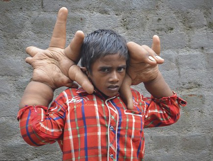 ידיים ענקיות (צילום: Barcroft India)