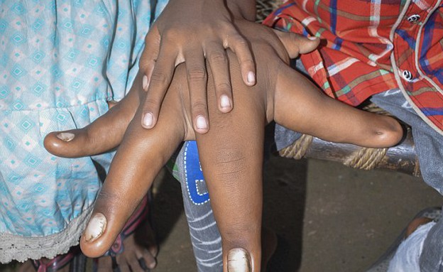 ידיים ענקיות (צילום: Barcroft India)