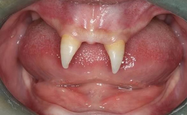 בעיות שיניים (צילום: oddee.com)