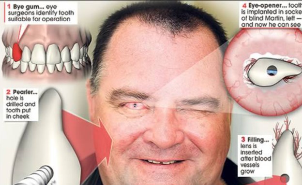 בעיות שיניים (צילום: oddee.com)