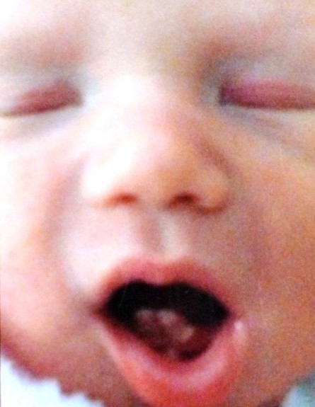 תינוקת עם שיניים (צילום: Wales Online)