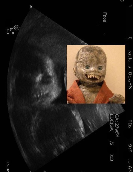 למי התינוק הזה דומה (צילום: buzzfeed.com)