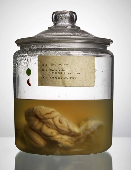 מוחות בצנצנת (צילום: אדם וורהז)