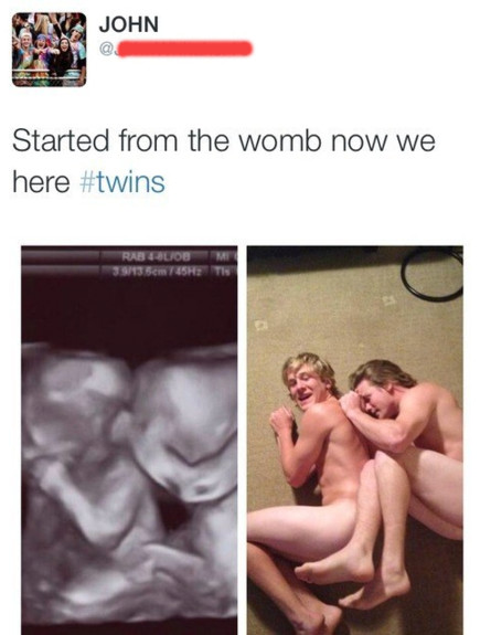 תאומים משחזרים תמונה מהרחם (צילום: טוויטר)