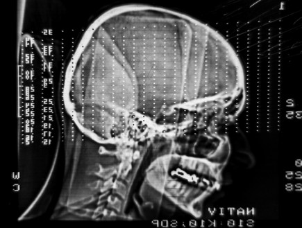 MRI (צילום: אימג'בנק / Thinkstock)
