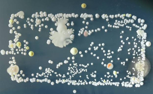 חיידקים בסמארטפון (צילום: University of Surrey)