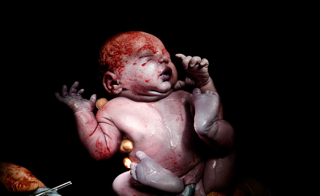 כריסטיאן ברתלו - לידה תינוק קיסרי (צילום: christianberthelot.com)