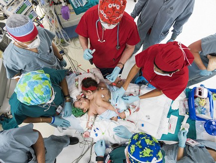 קאנטלי-הופ ואדלין-פיית'  (צילום: allen s.kramer/texax children hospital)