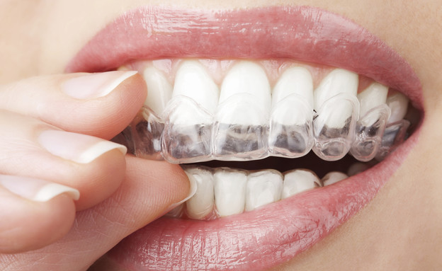 פלטה ליישור שיניים (צילום: OlgaMiltsova, Thinkstock)