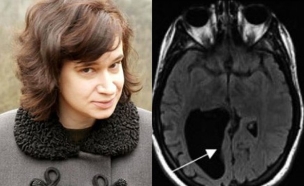חור במוח (צילום: nypost.com)