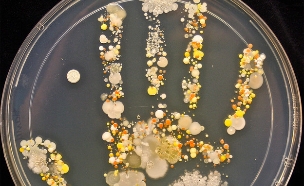 מיקרובים (צילום: טשה סטורם)