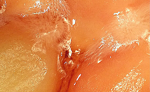 "הכל כבר כאן"