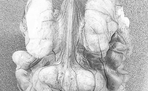 "הכל כבר כאן"