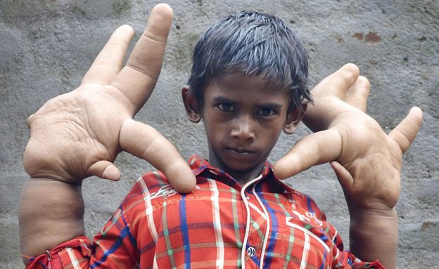ידיים ענקיות (צילום: Channel 5)