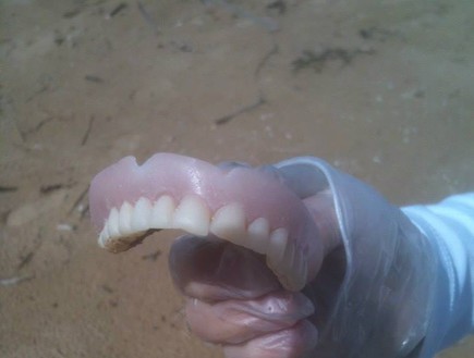 שיניים תותבות (צילום: אוהד מיכאלי)