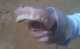 שיניים תותבות (צילום: אוהד מיכאלי)
