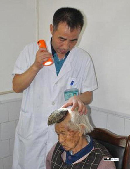 סינית עם "קרן" על הראש (צילום: mail online)