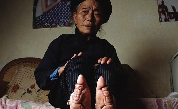 קשירת רגליים (צילום: dailymail)