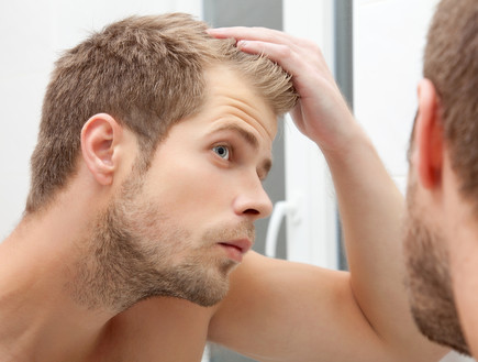התקרחות (אילוסטרציה: Shutterstock, מעריב לנוער)
