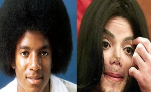 מייקל ג'קסון לפני ואחרי (צילום: מתוך plasticsurgeryindex.com)