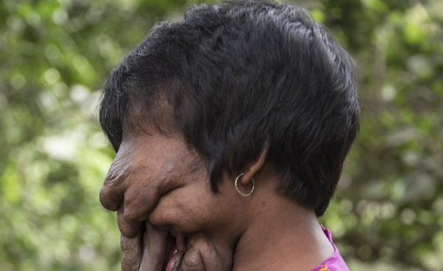 אישה ללא פנים (צילום: Cover Asia Press)