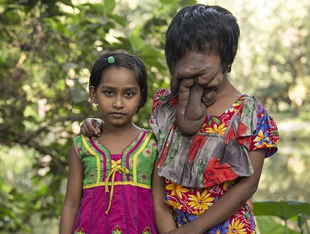 אישה ללא פנים (צילום: Cover Asia Press)