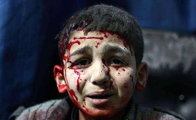 ילד סורי מחכה לטיפול (צילום: ABD DOUMANY, GettyImages IL)