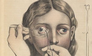 ניתוח עיניים (צילום: Welcome Library/London)