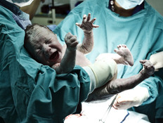 ניתוח קיסרי (צילום: Shutterstock)