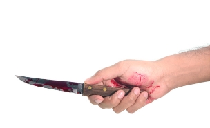 סכין עם דם (צילום: Shutterstock)