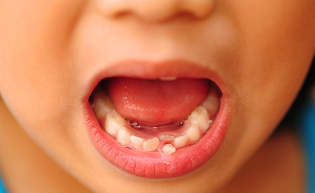 שיניים  (צילום: Shutterstock)