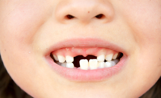 שיניים  (צילום: Shutterstock)