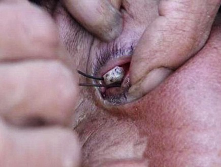 אבנים מהעיניים