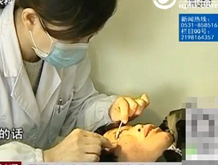 אבנים מהעיניים