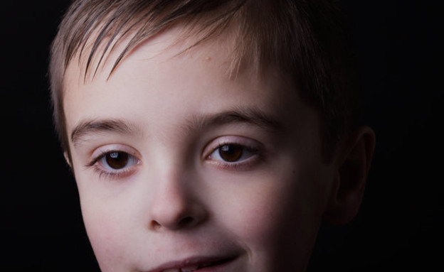 לקלן ילד עם מחלה נדירה (צילום: huffingtonpost.com)